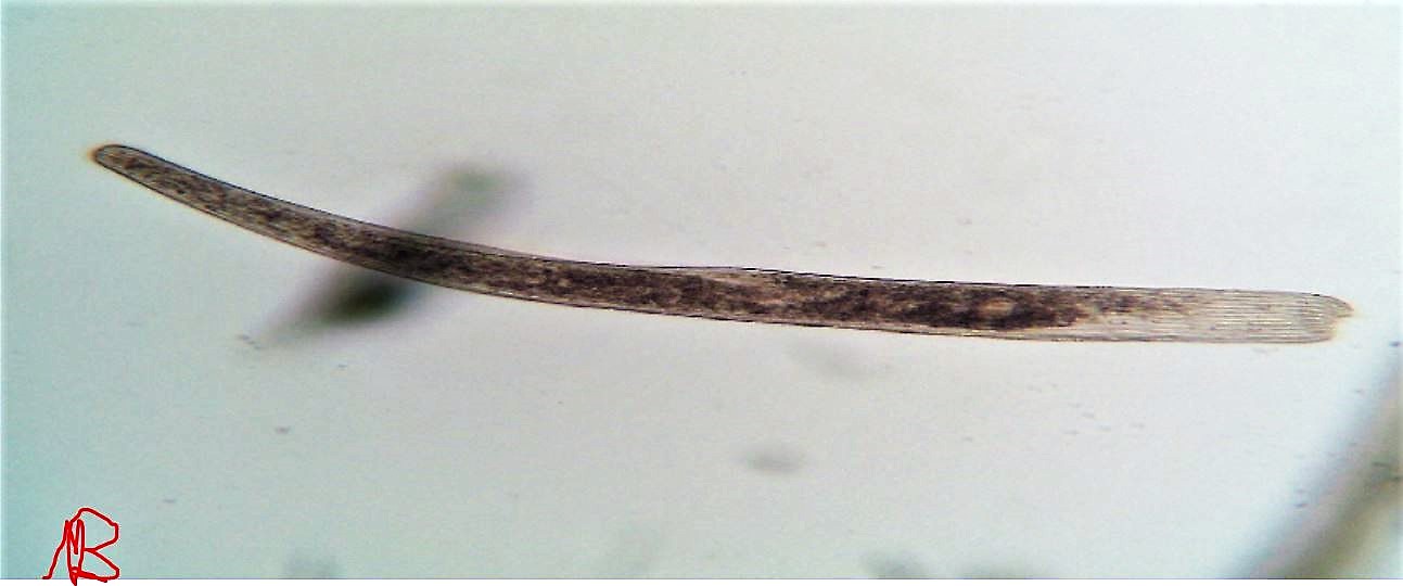 Spirostomum sp.
